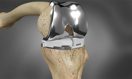 Knee & Shoulder Surgery